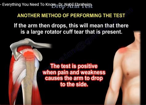 the drop arm test rotator cuff|shoulder test for rotator cuff.